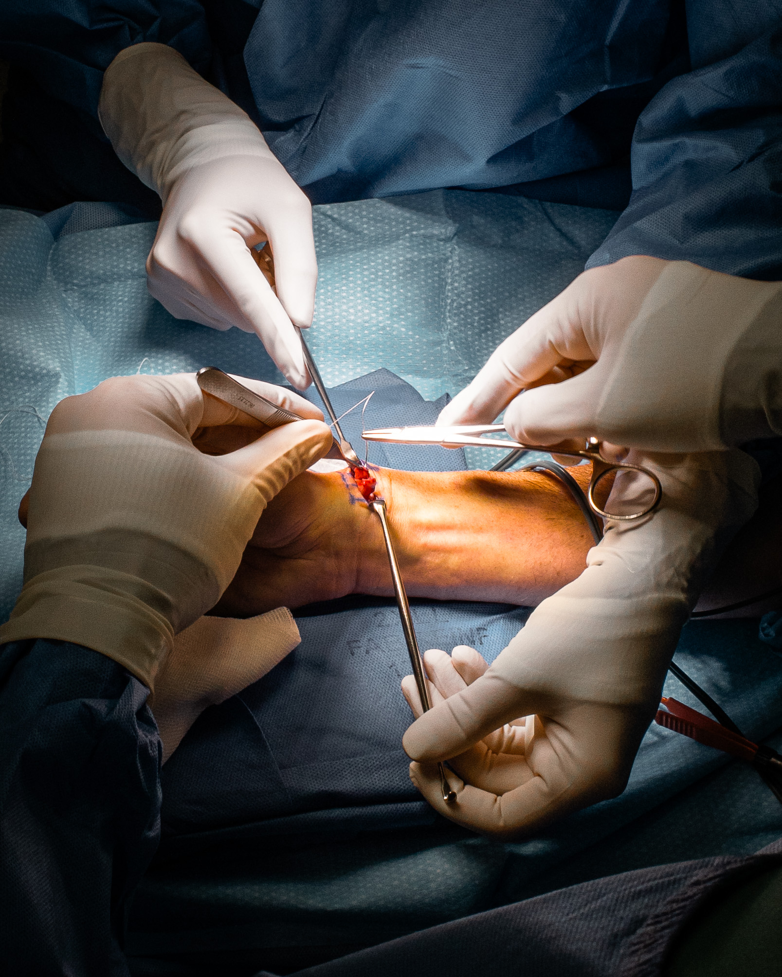 3 months in a surgery room.